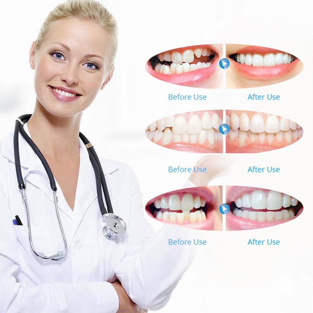 [HCM]Bộ Dụng Cụ Niềng Răng Tại Nhà - Niềng răng trong suốt ( 3 giai đoạn ) l Cho người lớn  l FREE SHIP