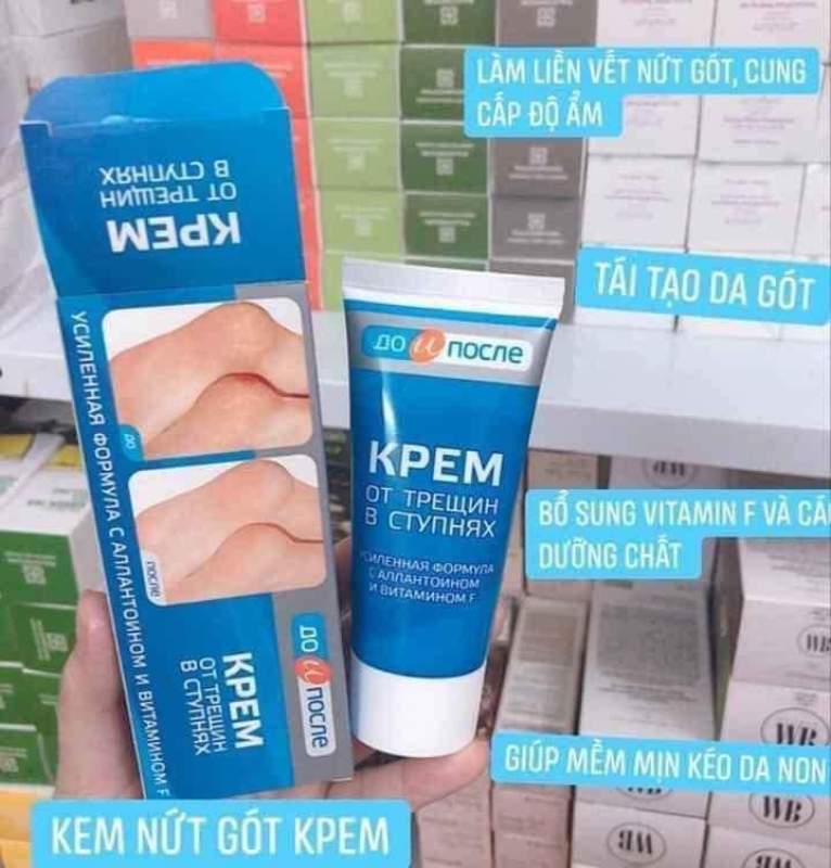 Kem dưỡng nứt nẻ gót chân KPEM 50ml