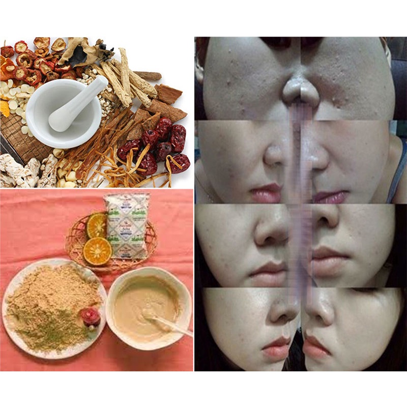 Mặt nạ bột thuốc bắc (trị mụn trắng da) - 200G