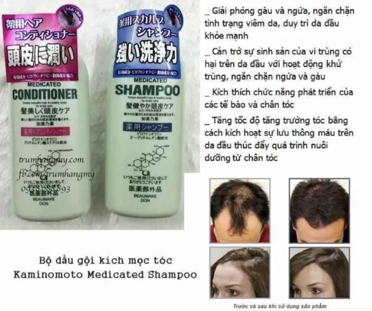 Bộ dầu gội xả Nhật Bản Kaminomoto 300ml