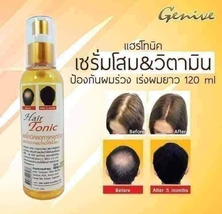 Serum xịt mọc tóc, giúp mái tóc dày dặn mềm mượt genive thái lan