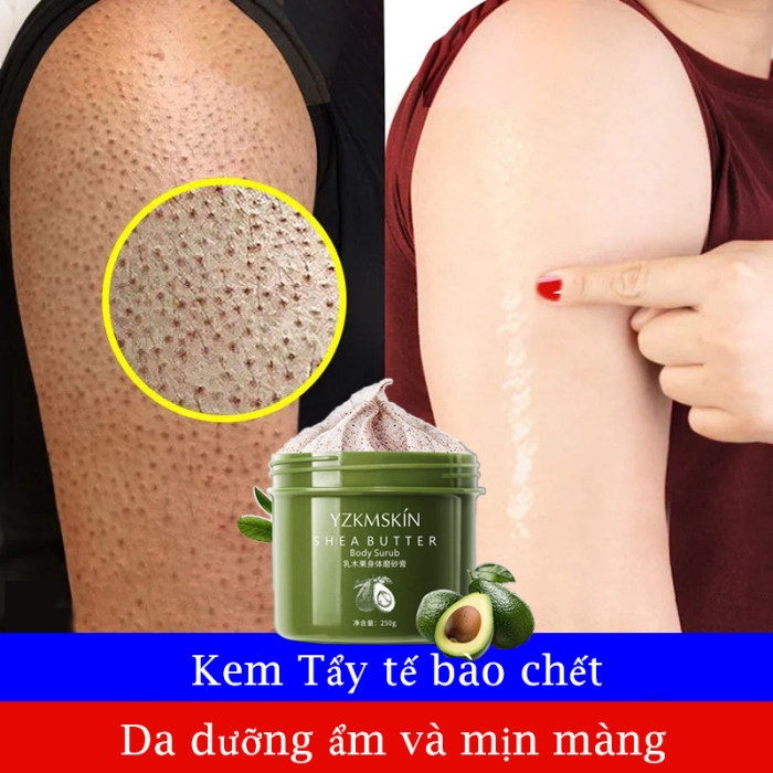 Kem tẩy tế bào chết làm sạch lớp da sừng, tẩy sạch tế bào chết toàn thân, kem tẩy tế bào chết toàn thân, tẩy tế bào chết đem lại làn da mới trắng sáng bất ngờ 250g.