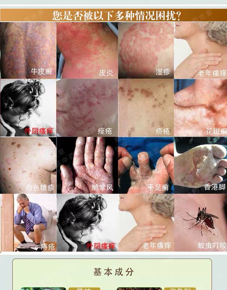 Kem bôi ngoài da HUOJIANDUI YiJun Rugao 18gr chuyên hỗ trợ giảm nấm các loại hắc lào vảy nến á sừng nưt ne ngứa ngoài da TOP 10 LOẠI kem bôi ngoài da tốt nhất Trung Hoa 3