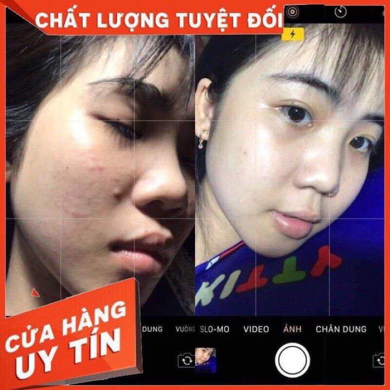 thảo mộc xanh chính hãng