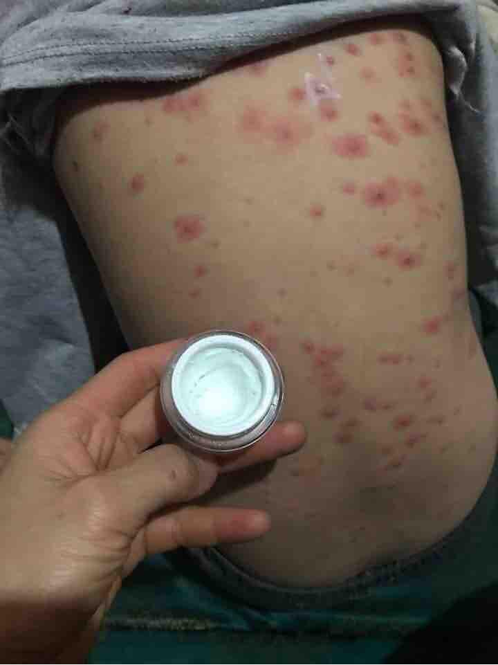 Kem bôi da bà vân