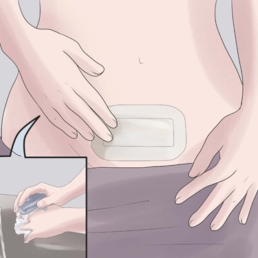 [HÀNG THÁI] Băng keo dán miếng dán có kèm gạc vô trùng hút dịch bảo vệ vết thương mổ sau sinh, băng gạc dán bảo vệ vết thương mổ, băng dán kèm gạc vô trùng URGO URGOSTERILE 25cm x9cm