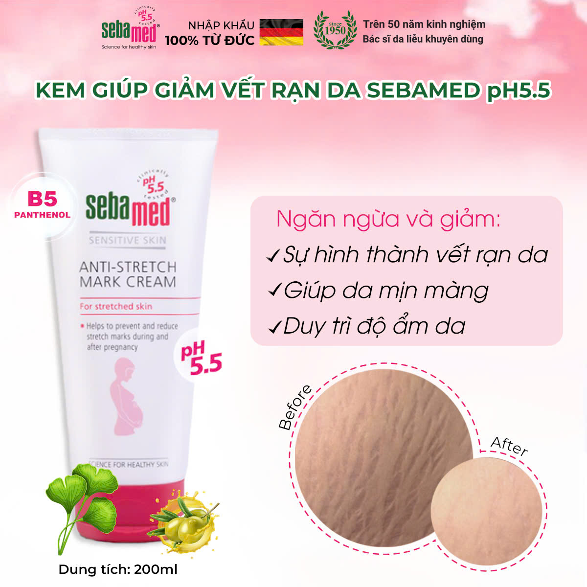Kem ngăn ngừa rạn da bà bầu Sebamed Anti-Stretch Mark Cream pH5.5