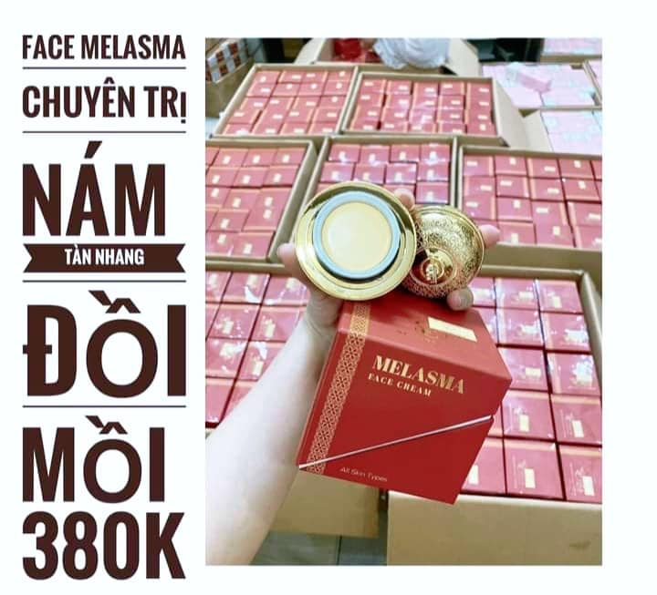 Face melasma cream, Kem face Nám sica white, Kem loại bỏ Nám, Kem face sica white, kem Nám sica