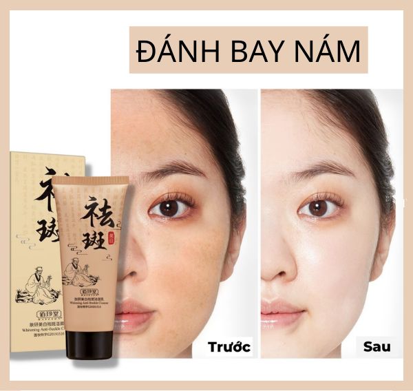 Sữa rửa mặt trắng da, sạch nám làm sạch sâu, loại bỏ sắc tố da bụi bẩn, mụn, dầu nhờn, dưỡng ẩm cho da