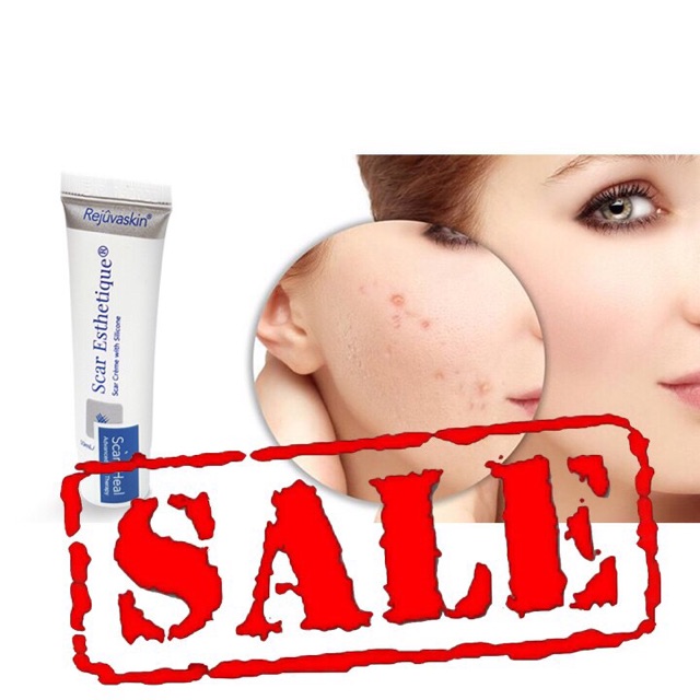Kem xóa mờ sẹo số 1 scar mỹ