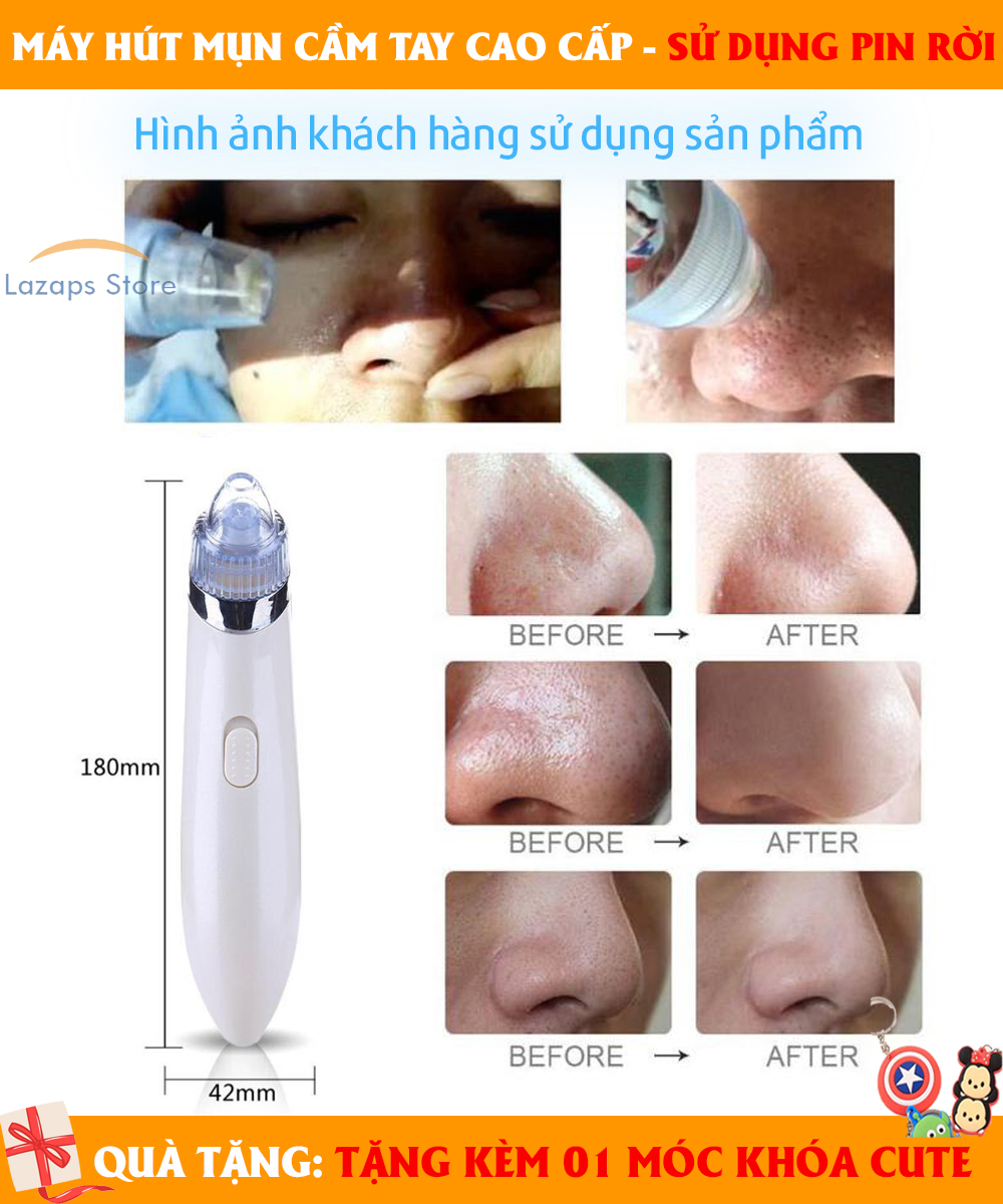 Máy hút mụn Beauty Skin, cách để trị mụn đầu đen và mụn cám dễ dàng,  máy hút mụn cầm tay, - Sở hữu 3 đầu hút hiệu quả, Hút sạch mụn và bụi bẩn - Giúp mát xa làm căng da mặt, mờ nếp nhăn dễ dàng!