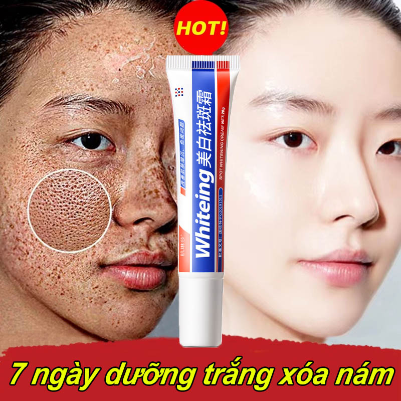 （HCM)Kem làm trắng và loại bỏ nám tàn nhang Kem nám và chống tàn nhang 20g Kem làm mờ vết thâm làm trắng da Serum xóa vết thâm làm sáng da, Giúp Dưỡng Trắng, Mờ Thâm Nám, Làn Da Đều Màu, giảm đốm tàn nhang, Cam Kết Sạch 95% Nám