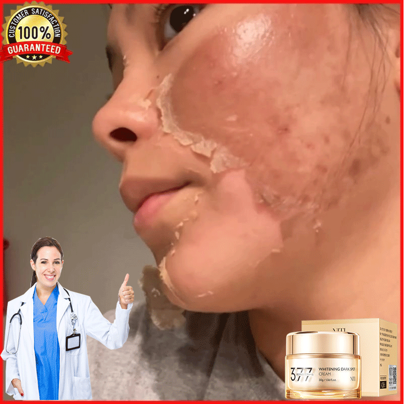 Kem xóa tàn nhang 30g kem xóa nám làm trắng da tinh chất chất làm trắng da mặt và loại bỏ nám làm sáng da chăm sóc Tinh chất peel da bóc tách nám tàn nhang sẹo rỗ lõm mụn thâm