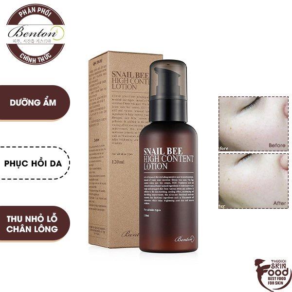 Sữa Dưỡng Ẩm Phục Hồi Da Giúp Da Săn Chắc Chiết Xuất Ốc Sên Benton Snail High Content Lotion 120ml