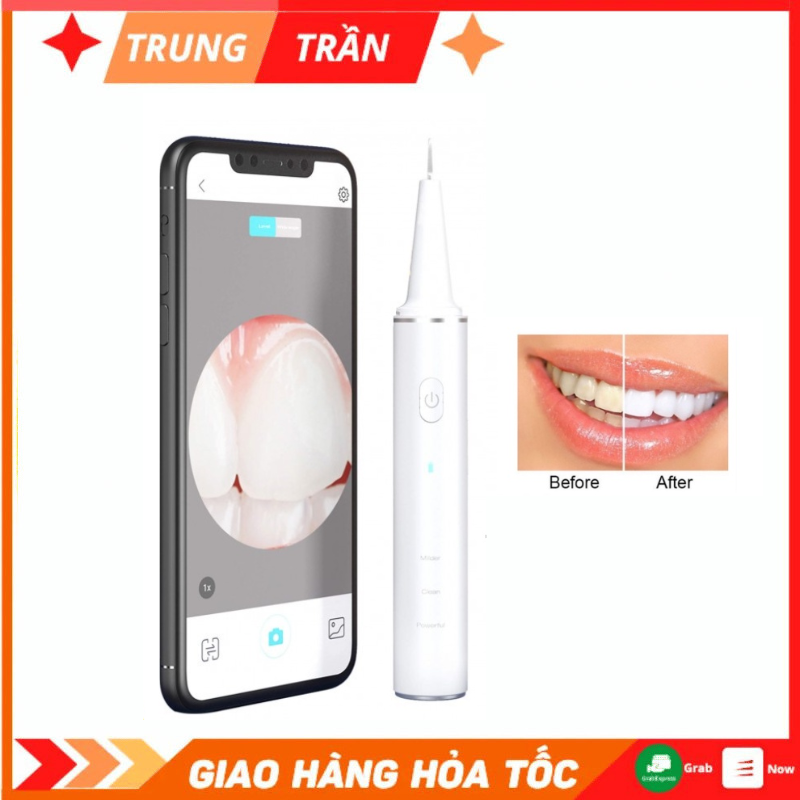 Máy lấy cao răng, cạo vôi răng Xiaomi tại nhà Xiaomi Sunuo T12 pro-Tích hợp camera siêu nét xem qua điện thoại, Bảo hành chính hãng 12 tháng