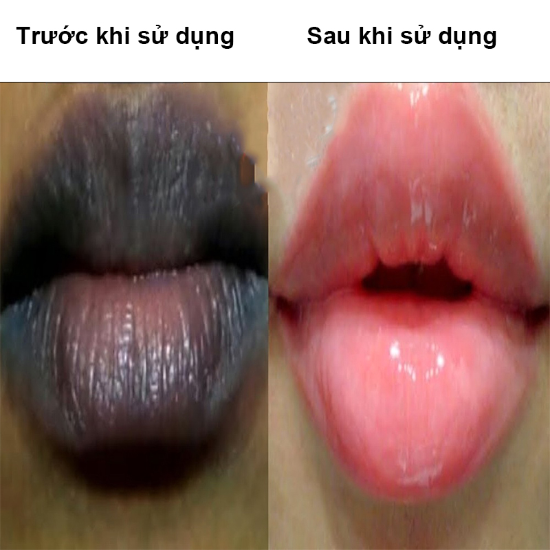 Son dưỡng môi mặt nạ môi kem môi son dưỡng môi dior chăm sóc vùng môi, tinh chất chăm sóc trẻ hóa môi, dưỡng ẩm môi, phục hồi môi khô nứt son dưỡng môi vaseline