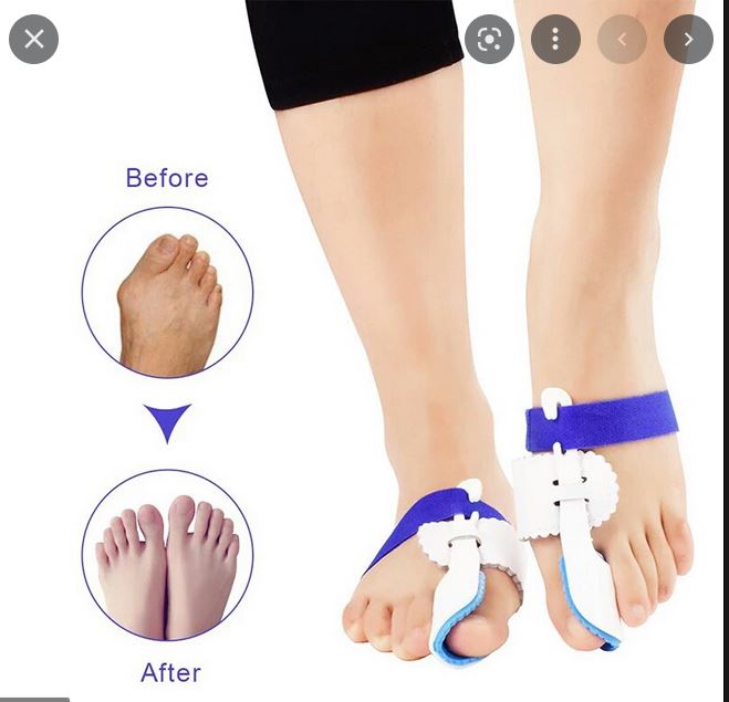 Dụng cụ nẹp định hình ngón chân