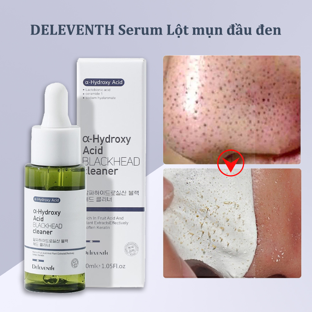 DELEVENTH Serum Lột Mụn Đầu Đen Làm Sạch Lỗ Chân Lông Blackhead Remover Giảm Hắc Tố Serum Lột mụn đầu đen Ngăn ngừa mụn đầu đen Lột mụn đầu đen Lột mụn trứng cá