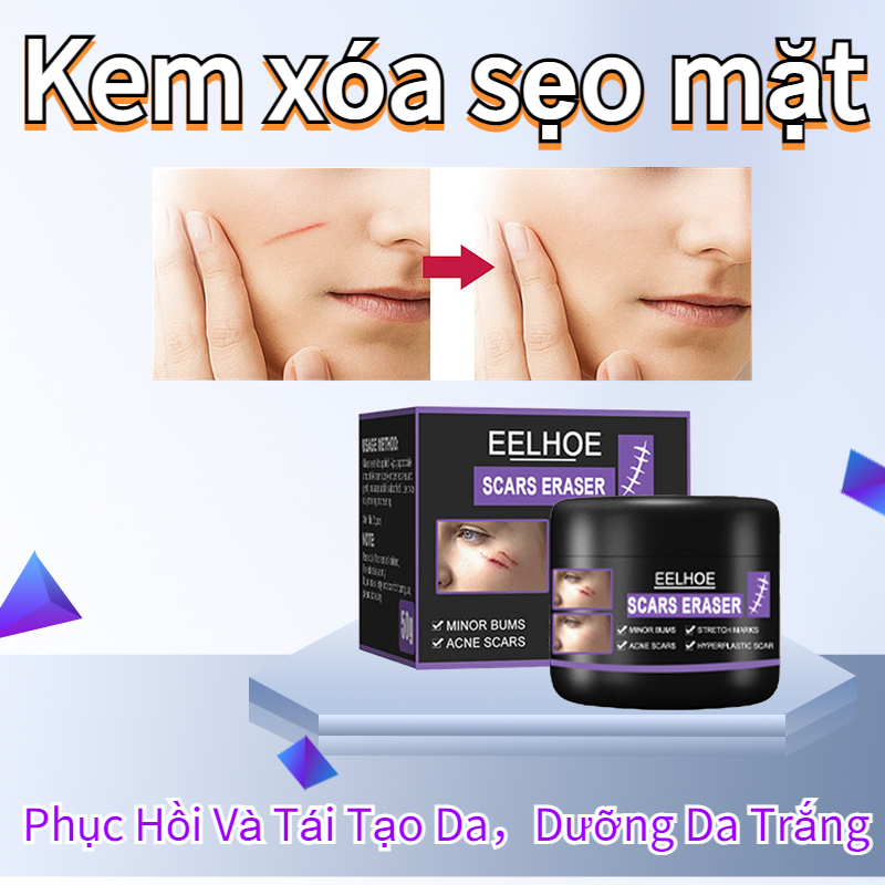 Kem xóa sẹo mặt Làm Trắng Da dành cho mọi loại da thúc đẩy sẹo rỗ sẹo thâm Phục Hồi Và Tái Tạo Da Dưỡng trắng da
