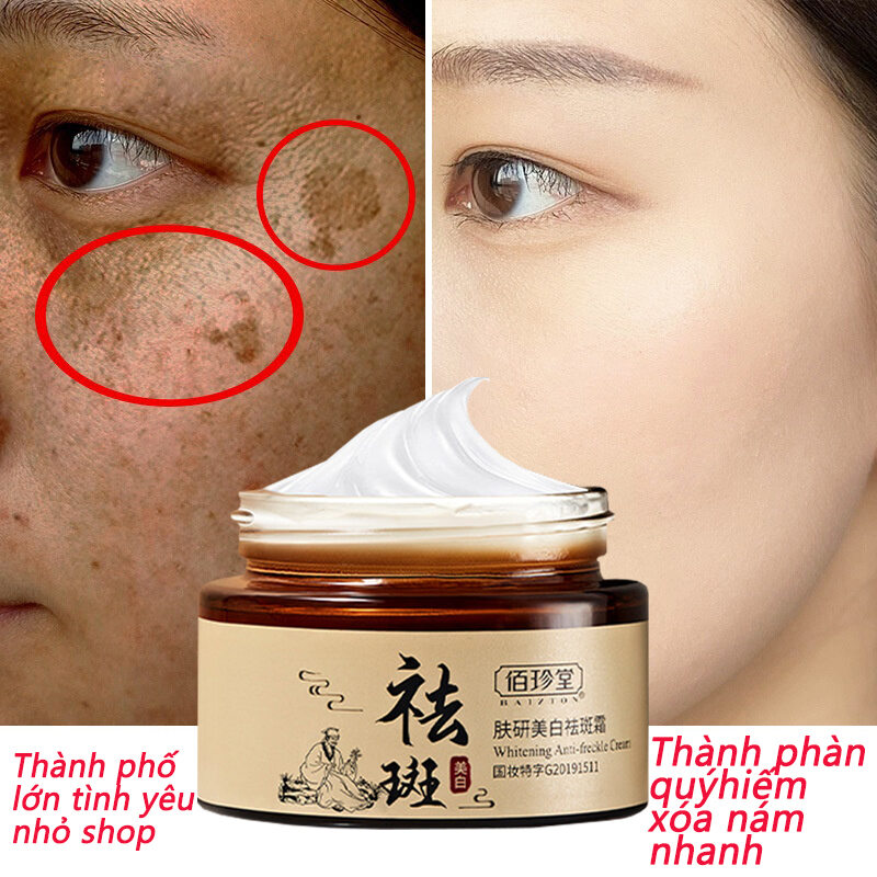 Kem làm mờ nám tàn nhang，kem làm mờ vết nám tàn nhang đồi mồi da mặt，Kem nám và chống tàn nhang thảo dược ，xóa tàn nhang xóa vết thâm nám tàn nhang vết chân chim đồi mồi làm mờ hắc tố làm trắng da săn chắc da kem nam nữ cấ tan nhang 30g