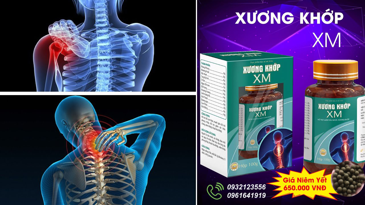 Xương Khớp XM | Đông Y Xứ Mường | Hỗ Trợ Điều Trị Thoái Hóa Khớp, Viêm Đa Khớp, Đau Dây Thần Kinh Toại| Tặng Kèm Cao Xoa Bóp XM