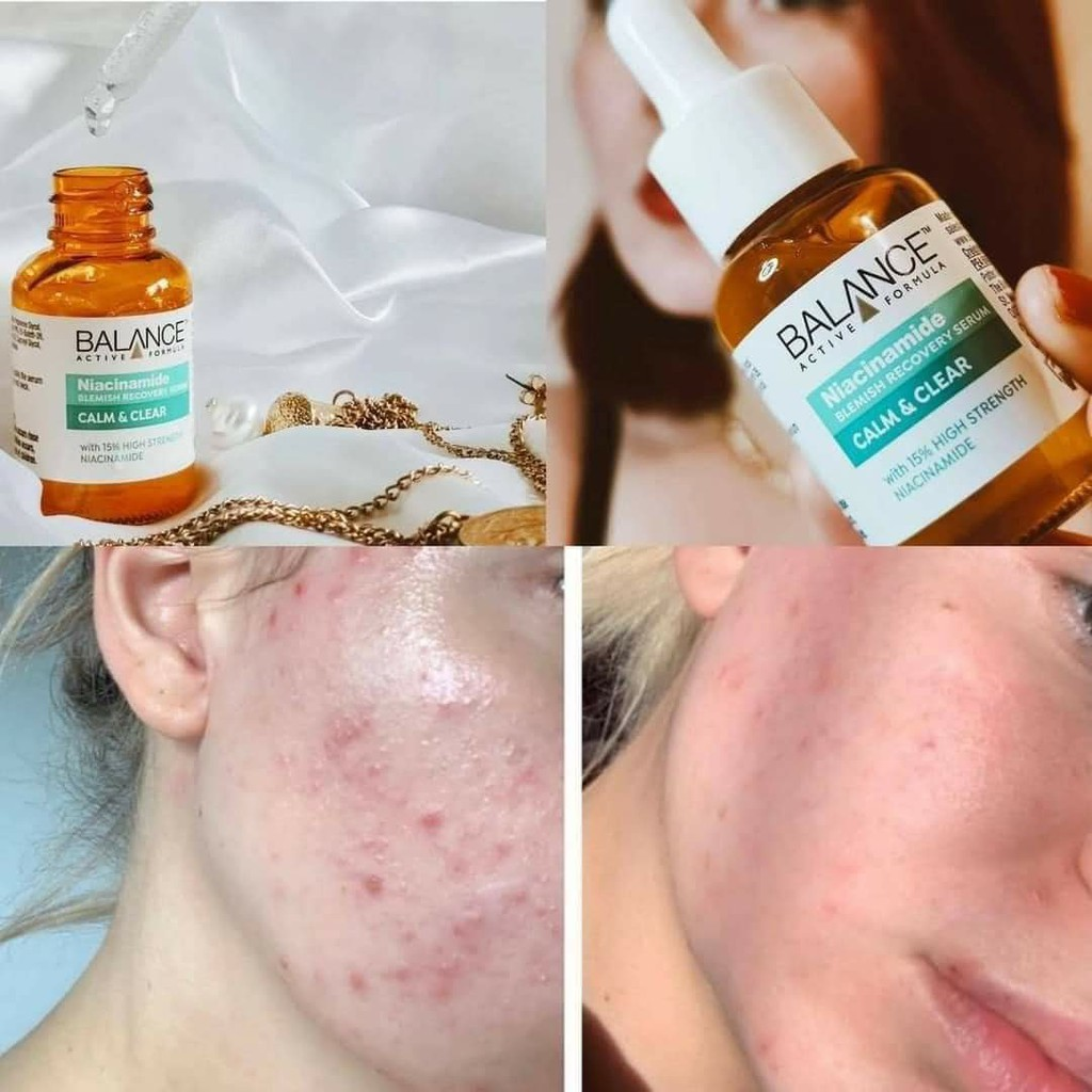 Tinh chất Balance Active Formula ngừa mụn mờ thâm 30ml Niacinamide 15% Blemish Recovery Serum
