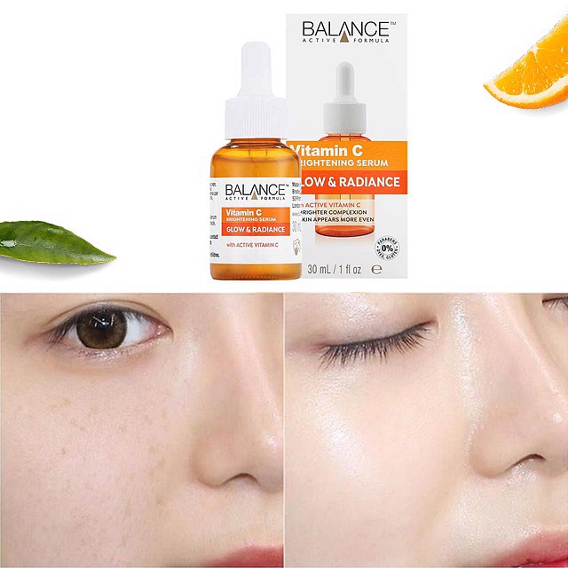 Serum Trắng Da, Mờ Thâm Balance Active Formula Vitamin C Brightening 30ml