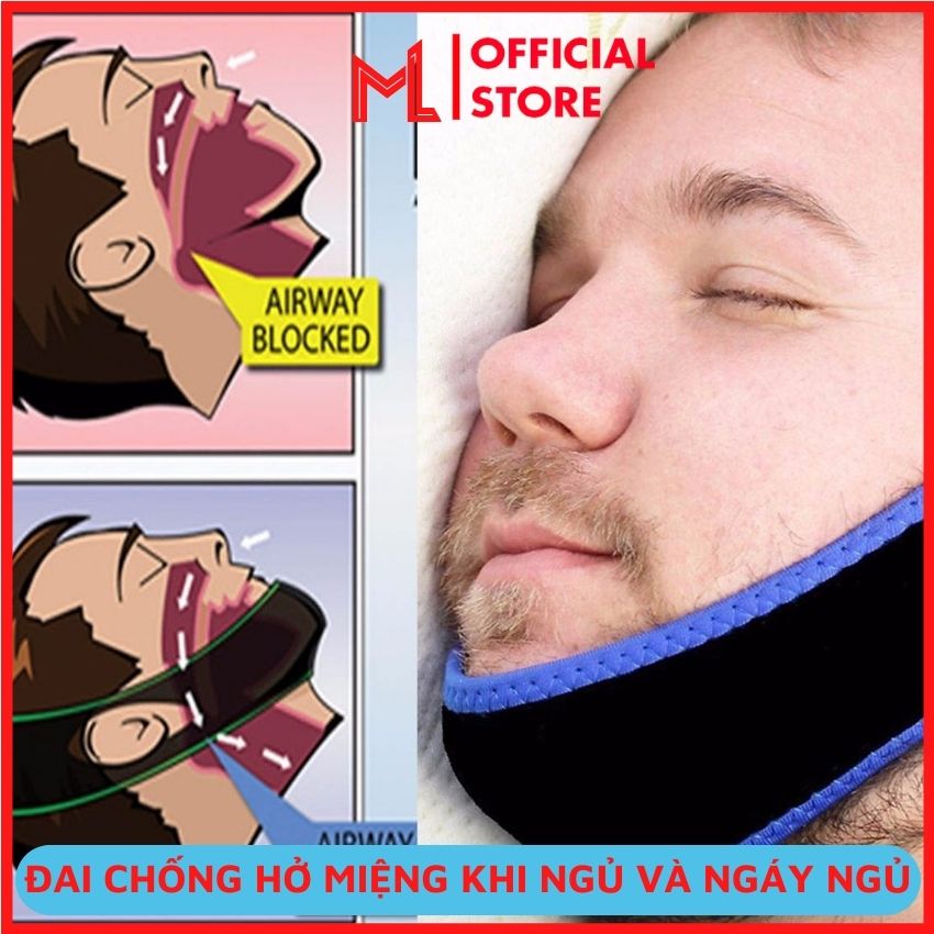 Đai chống hở miệng đai chống ngáy khi ngủ k1, tiện ích giúp ngủ ngon cho nam và nữ, đai chống ngáy và hở miệng khi ngủ giúp có giấc ngủ ngon không bị khô miệng fansipan shop