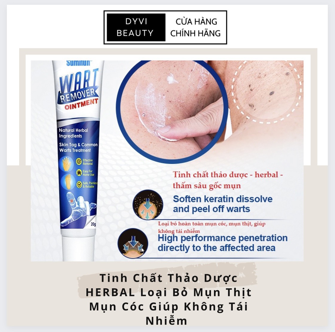 Kem thảo dược thiên nhiên đánh bay mụn cóc, mụn thịt, chiết xuất thảo dược giúp hết mụn cóc, mụn thịt