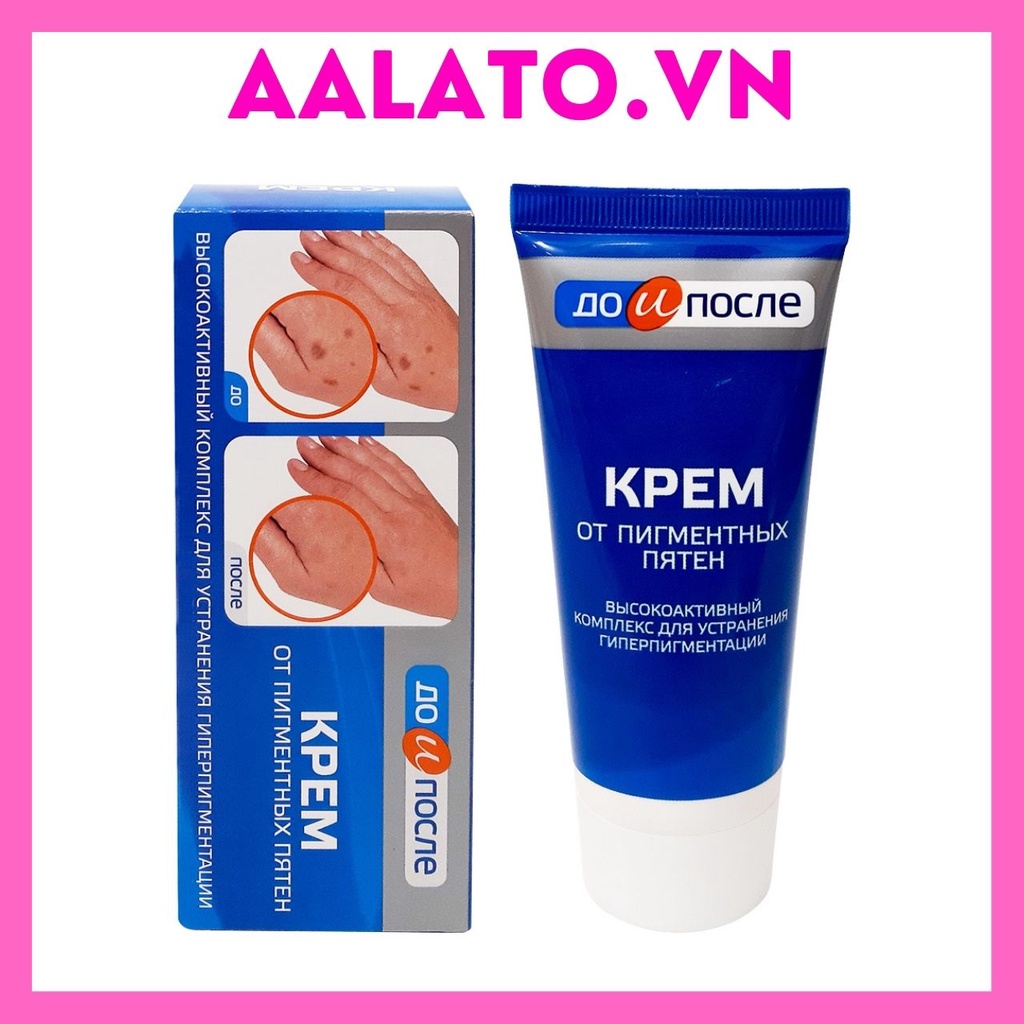 Kem đồi mồi tay chân Kpem Nga - Kem giảm đồi mồi giảm nám tàn nhang tay chân KPEM