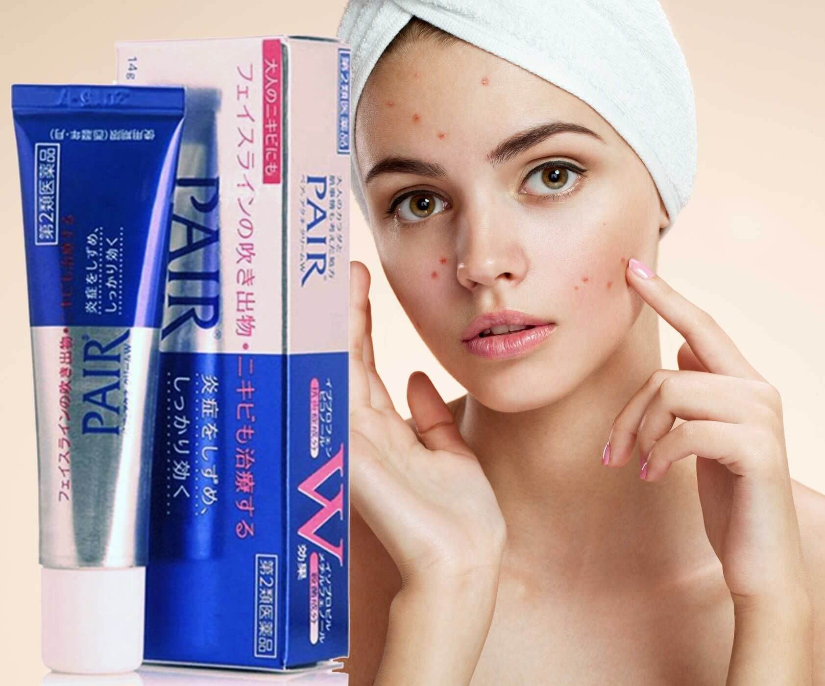 Kem Hỗ Trợ Cải Thiện Mụn Pair Nhật Bản 24g giảm mụn, sưng tấy, mụn cám, mụn mủ chỉ sau 3-4 ngày sử dụng