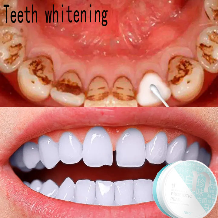 Hộp 50g bột tẩy trắng răng thích hợp khi dùng với kem đánh răng - INTL
