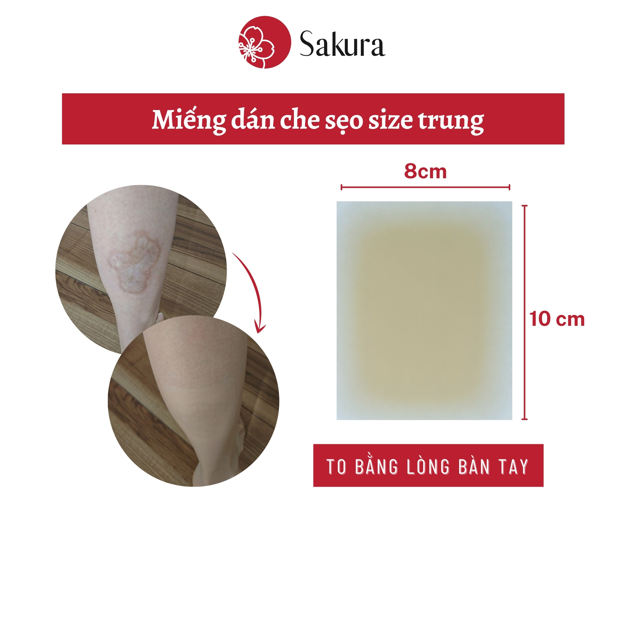 Miếng dán che sẹo Nhật Bản Sakura 8x10cm che sẹo lồi, sẹo lõm, sẹo phẫu thuật chống nước, an toàn cho da