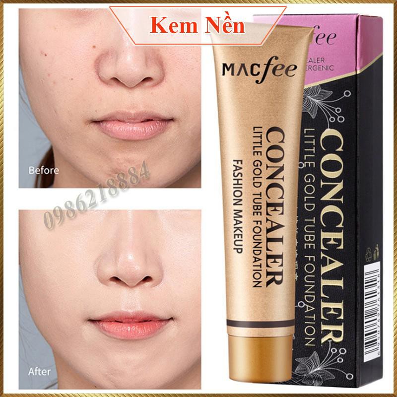 Kem nền che khuyết điểm toàn diện Macfee Concealer Hypoallergenic MCH2