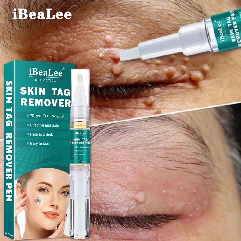 Gel tẩy nốt ruồi, mụn cơm, mụn cóc, mụn thịt, tẩy nốt ruồi ibealee , hàng chuẩn 100%