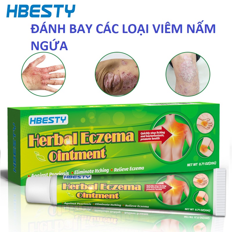 Kem Bôi Ngoai Hết Ngứa Lang Ben Hắc Lào Nấm Vẩy Nến Á Sừng Mề Đay Chàm Muỗi Đốt Viêm Da Hắc Lào Ghẻ Lở...