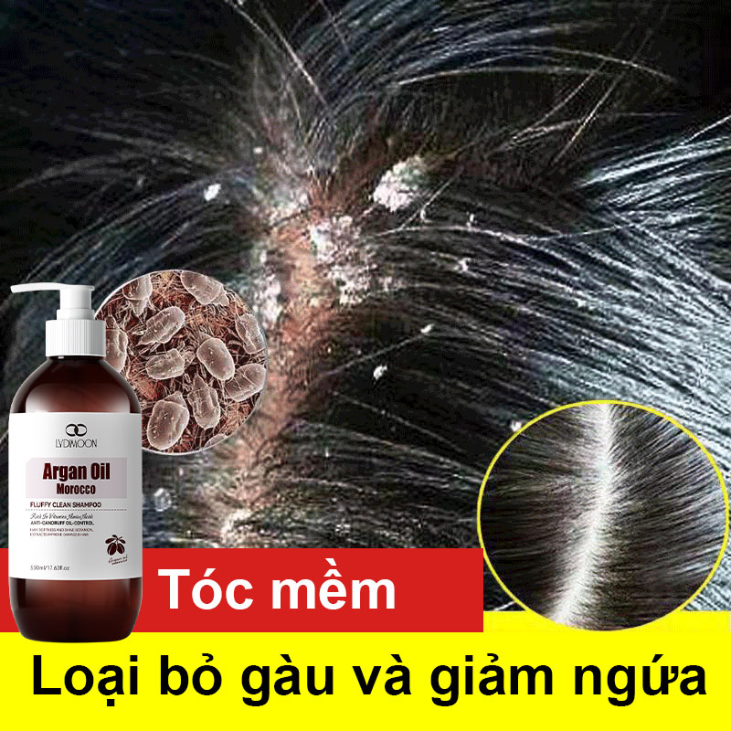 Dầu gội thảo dược và dầu gội trị gàu, làm sạch gàu, nấm da đầu, loại bỏ bã nhờn, phục hồi nang tóc, giúp tóc mọc nhanh hơn 500ml