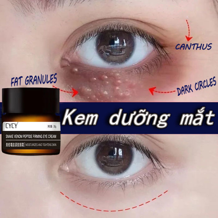 Kem mắt quầng thâm kem dưỡng ẩm mắt xóa quầng thâm mắt loại bỏ các hạt chất béo kem dưỡng mắt kem dưỡng trắng da mắt 30g dưỡng ẩm chăm sóc da Có hiệu lực trong 7 ngà Kem Dưỡng Trắng Da Dưỡng Ẩm Giảm Quầng chống bọng mắt loại bỏ nếp nhăn