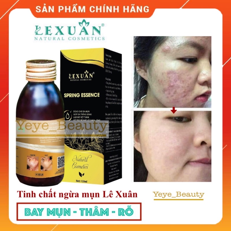Trị mụn thảo dược đông y Lê Xuân