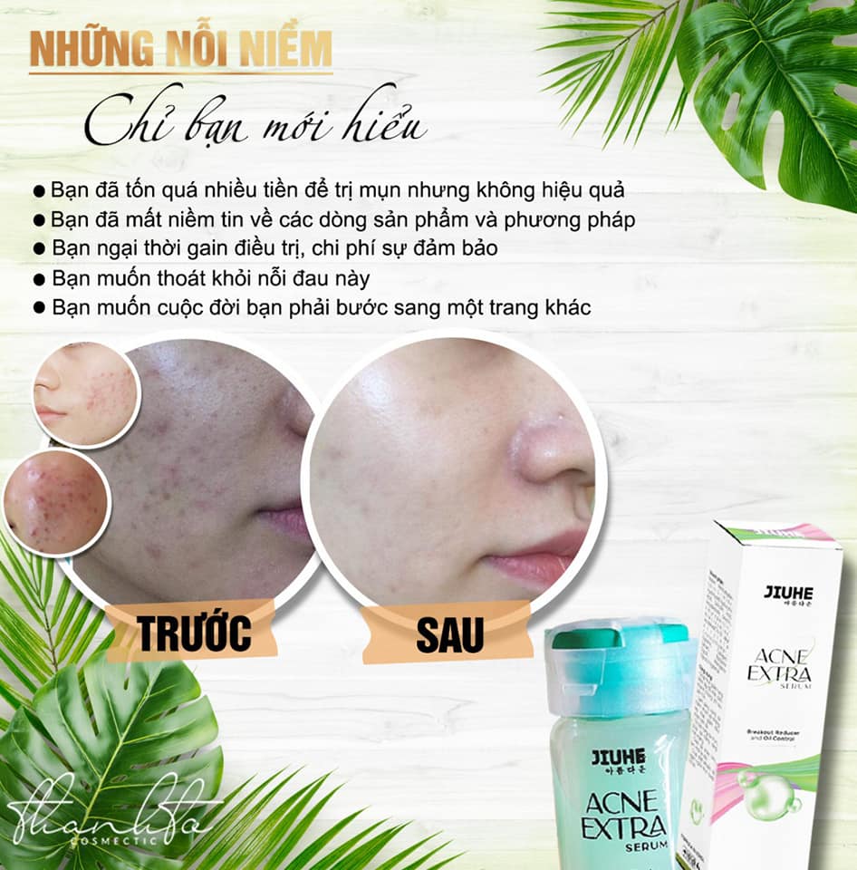 Serum chuyên mụn Jiuhe Acne extra