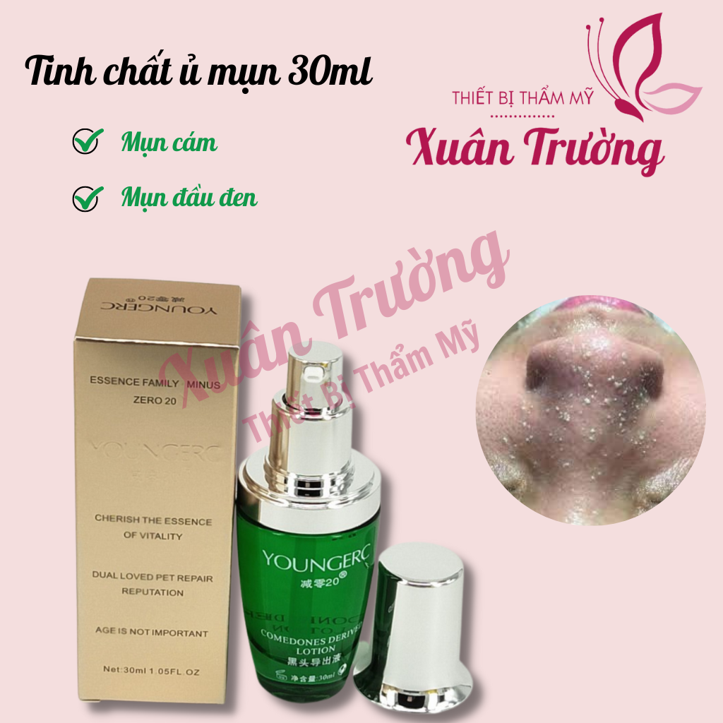Ủ mụn đầu đen, mụn cám, Ủ mụn Youngerc chai 30ml