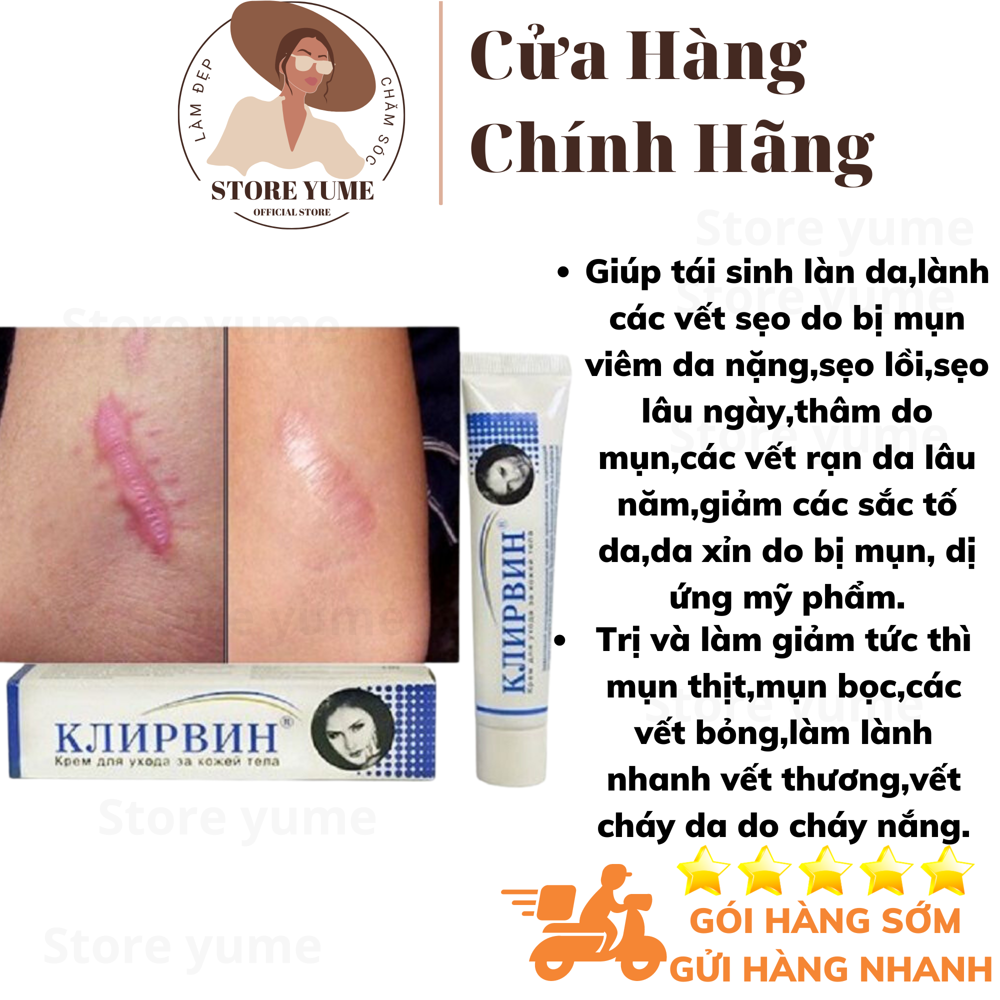 Kem tri. sẹo,giảm thâm sẹo,mụn,kem lành sẹo kjinp.bnh nga