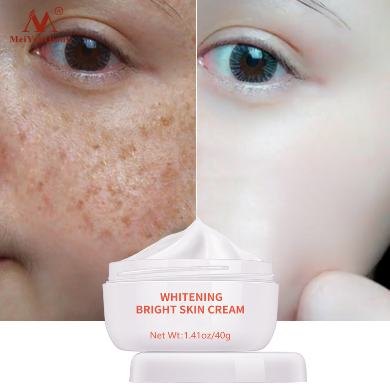 MeiYanQiong Kem dưỡng trắng dưỡng ẩm xoá tàn nhang làm sáng da 40g - INTL