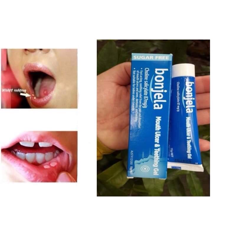 Gel bôi nhiệt miệng và mọc răng Bonjela cho bé từ 4 tháng tuổi trở lên hàng Úc 15gr(date10/2022)