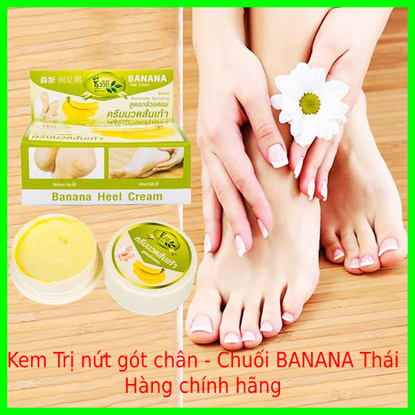 Kem Nứt gót Chân Banana Thái - Giảm ngay tình trạng nứt gót chân nam nữ