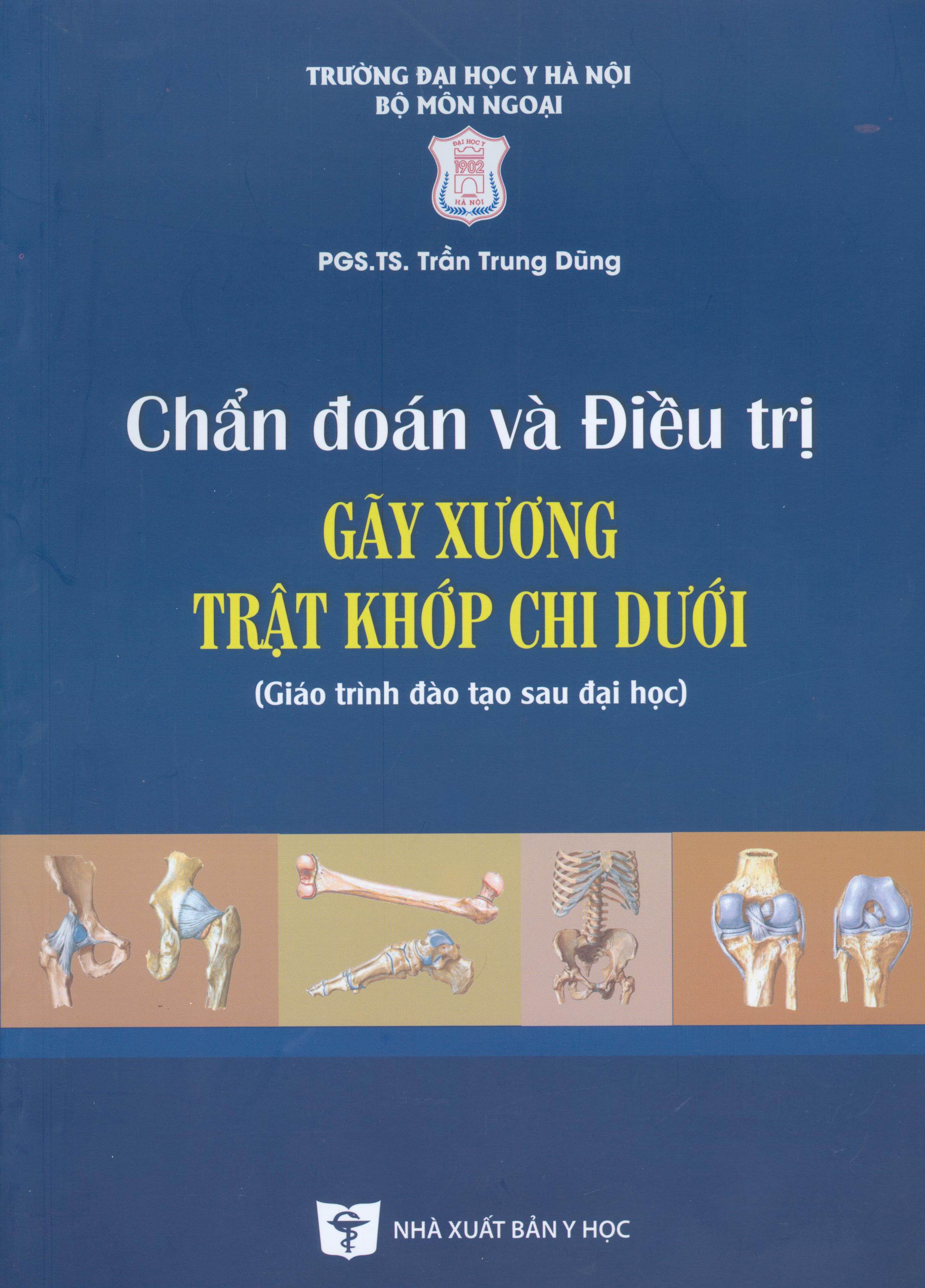 Tổng hợp Gãy Xương Ngành Ngồi Mu giá rẻ, bán chạy tháng 7/2023 ...