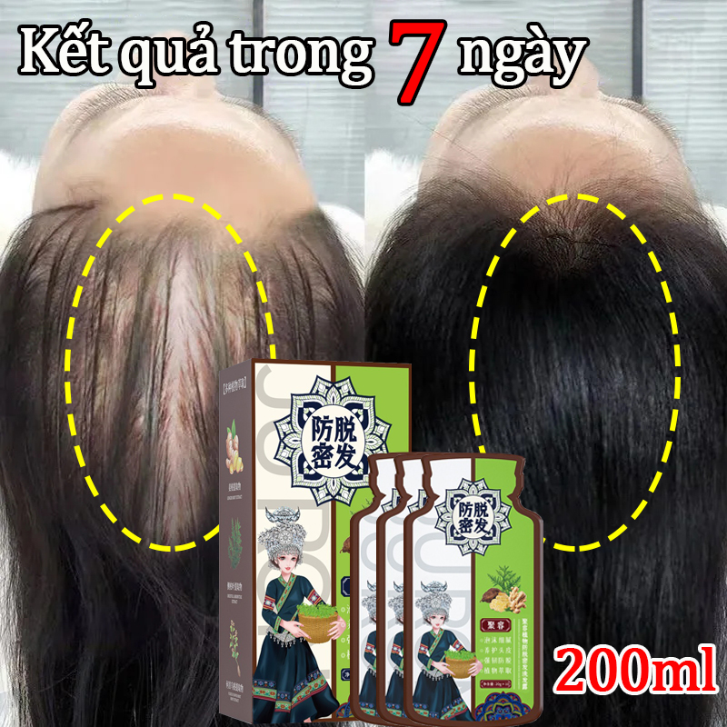 10pcs Rụng dầu gội tóc Dầu gội gừng Hỗ trợ tăng trưởng tóc, ngăn ngừa rụng tóc - dầu gội cho da dầu, dầu gội gừng, kích thích tăng trưởng tóc Sửa chữa khô và gãy tóc sau sinh, giải quyết vấn đề rụng tóc Dầu gội gừng tươi Cặp Dầu Gội Gừng