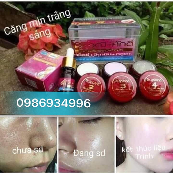 ( XẢ KHO ) BỘ 5 MÓN YANHEE ĐỎ CHERRY