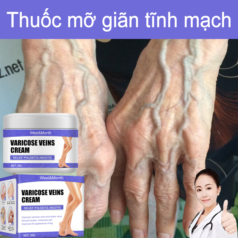 【Mua 2 tặng 1 Kem Thảo Dược Hỗ Trợ Giảm,Kem giãn tĩnh mạch chăm sóc vùng giúp lưu thông tĩnh mạch làm dịu đau đớn Loại bỏ sưng mạch máu tay chân phồng gân xanh kem bôi ngoài tĩnh mạch giãn tĩnh mạch chân 30g