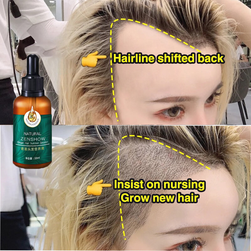 c tóc chân thực mọc tóc tự nhiên 10ml phục hồi mọc tóc giải quyết rụng tóc do thức đêm rụng tóc sau sinh rụng tóc thời kỳ trung niên ...tất cả các vấn đề rụng tóc từ chối cấy tóc